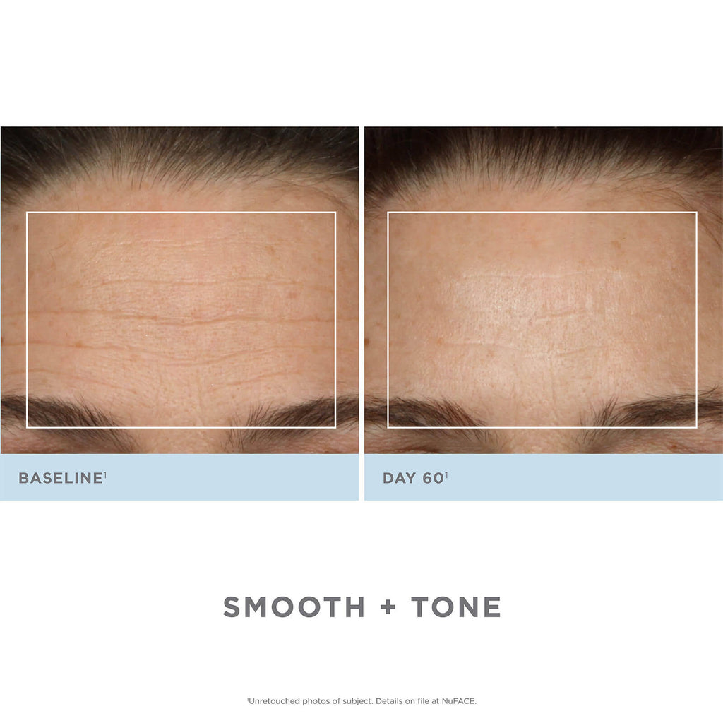 Trinity Facial Toning Device + Wrinkle Reducer Attachment Bundle C296661