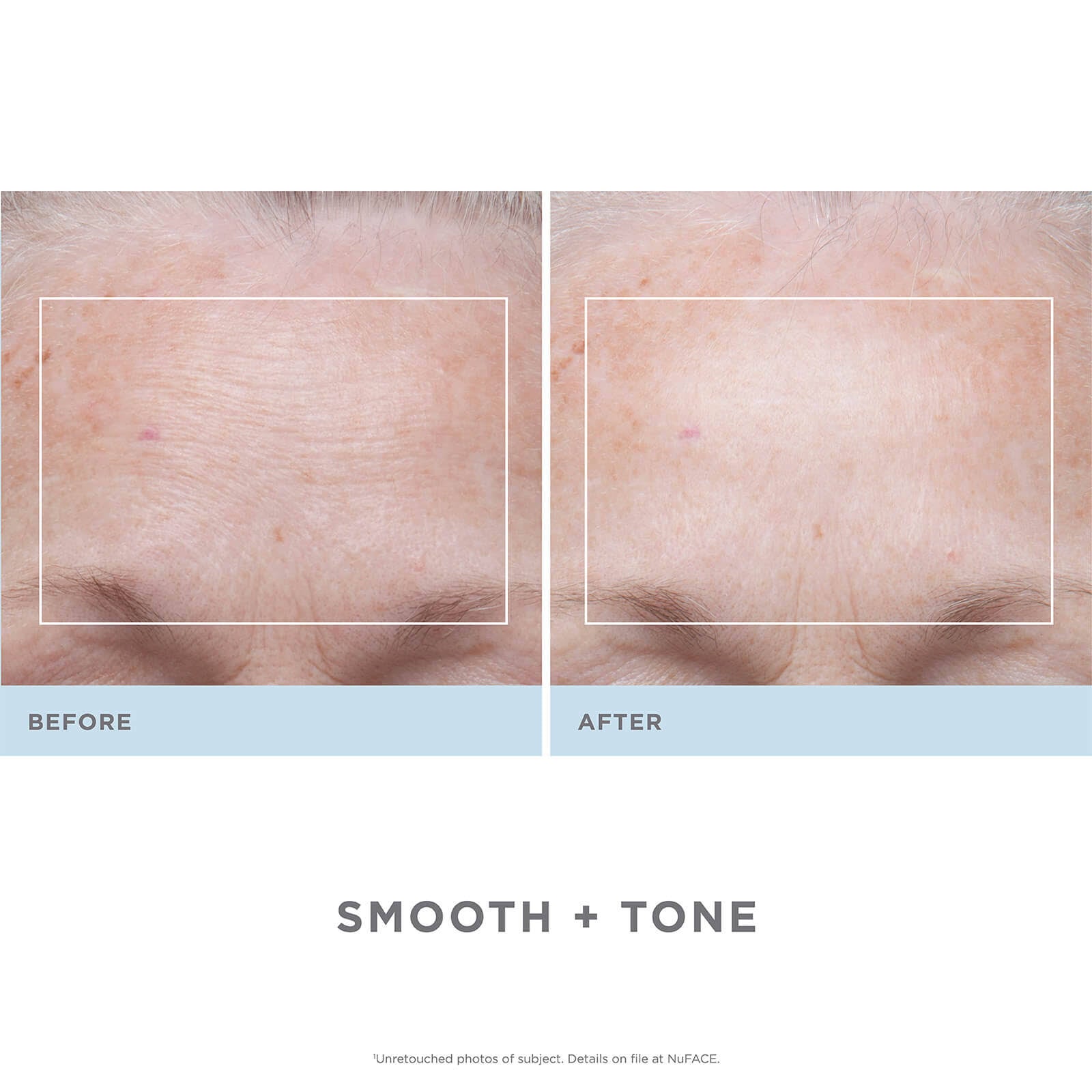 Trinity Facial Toning Device + Wrinkle Reducer Attachment Bundle C296661